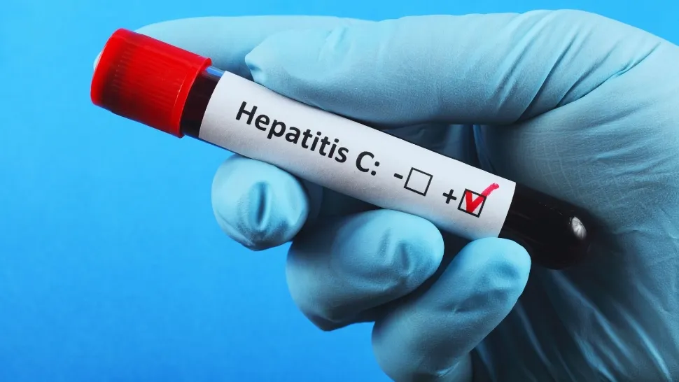 Hepatita toxică - principalele cauze și simptome. Medicii trag un semnal de alarmă: "În cazuri extreme se poate ajunge la transplant hepatic"