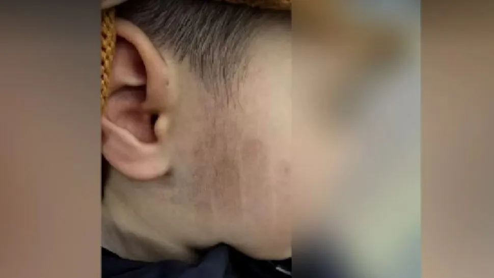 Anchetă la o grădiniță din Urziceni: un copil de 5 ani ar fi fost bătut crunt de o îngrijitoare pentru că a refuzat să doarmă