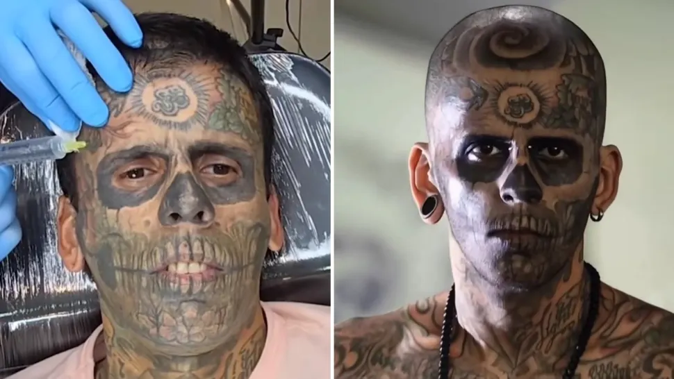 Cum arată bărbatul care și-a „șters” tatuajele ce îi acopereau 90% din corp? Transformarea este șocantă - FOTO/VIDEO
