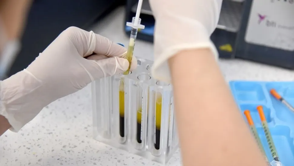 Terapia biologică folosită în recuperare
