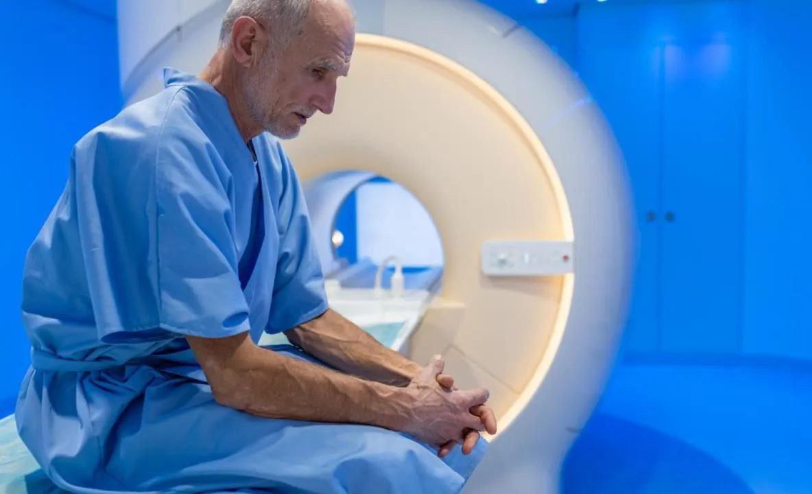 Testul recomandat pacienților cu cancer de prostată