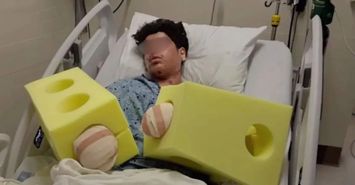 Adolescent mutilat de o petardă găsită pe stradă! Și-a pierdut mai multe degete, iar medicii încearcă să-i salveze mâna