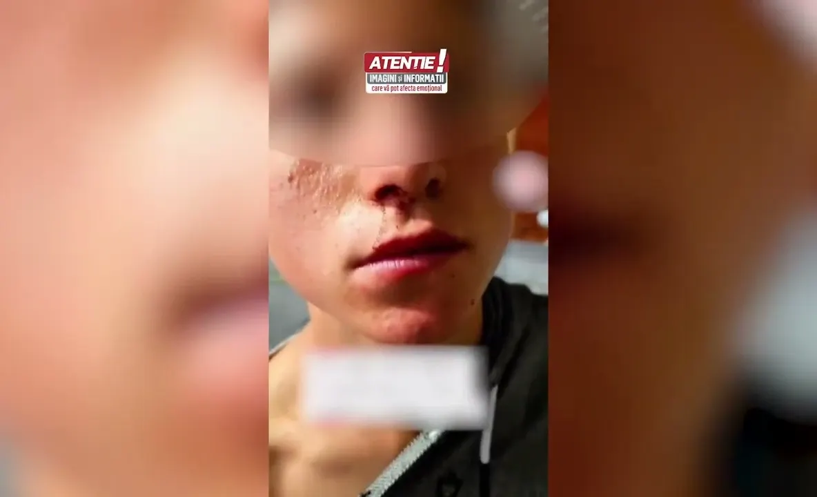 Copil de 14 ani, bătut cu bâtele de trei bărbați. I-au furat și turma de oi | VIDEO