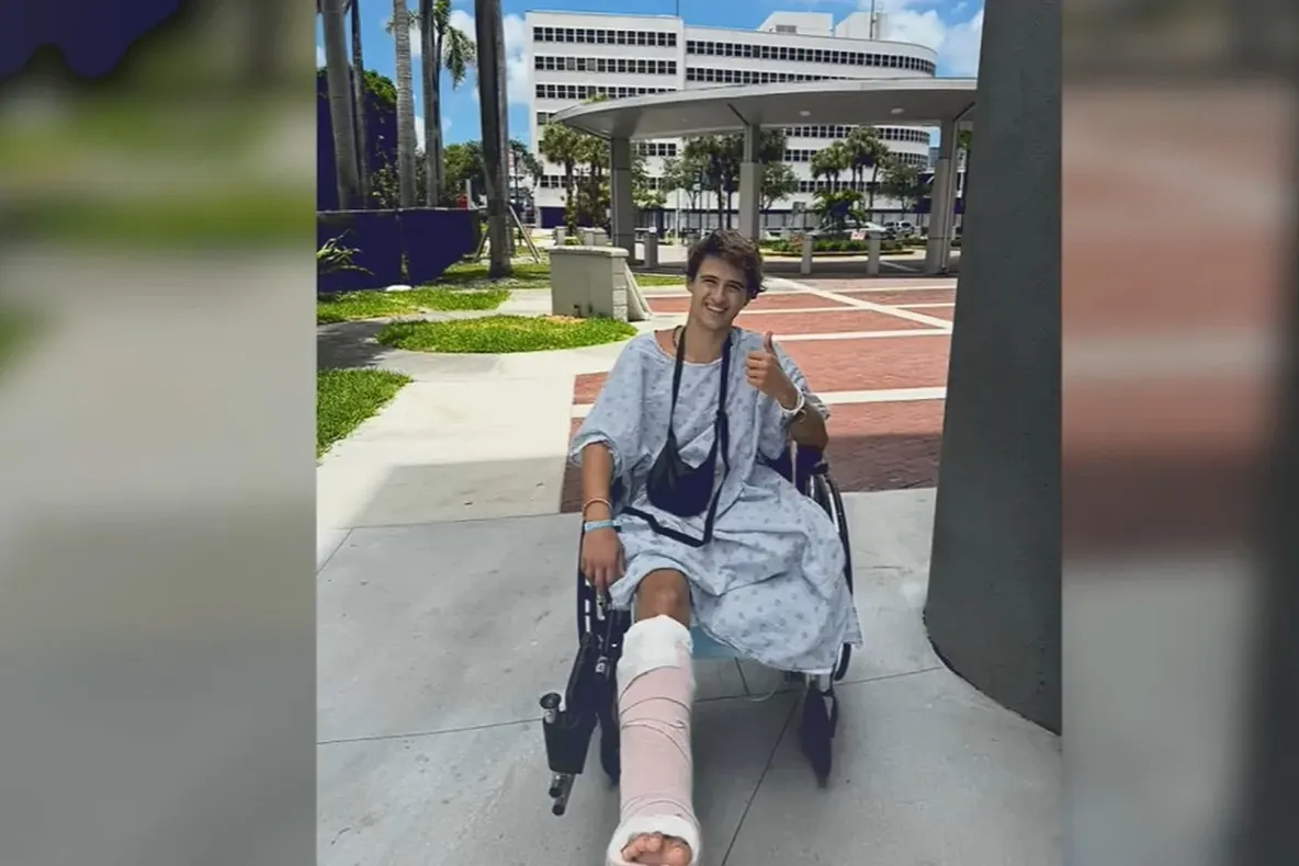 Un concurent Survivor a rămas fără un picior, după ce a fost lovit de elicea unei bărci