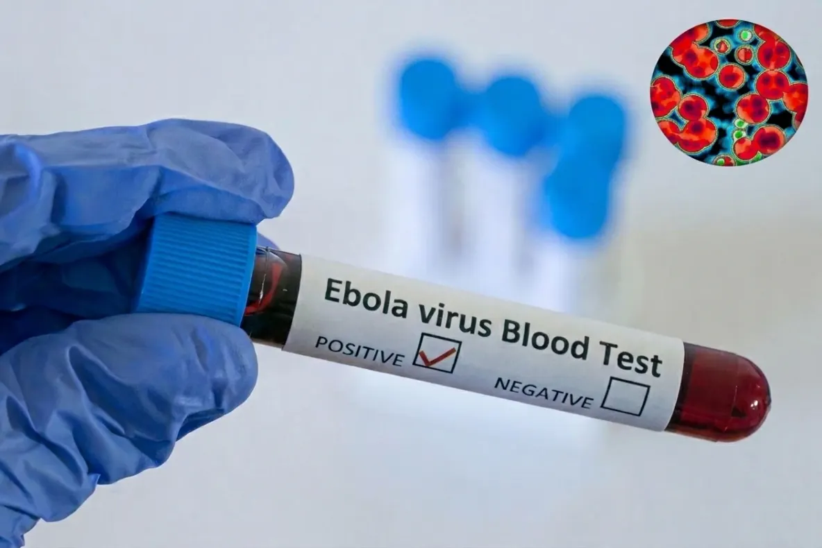 Epidemia de Ebola se extinde! Cinci țări, afectate de focarul mortal: Nigeria este ultimul stat afectat