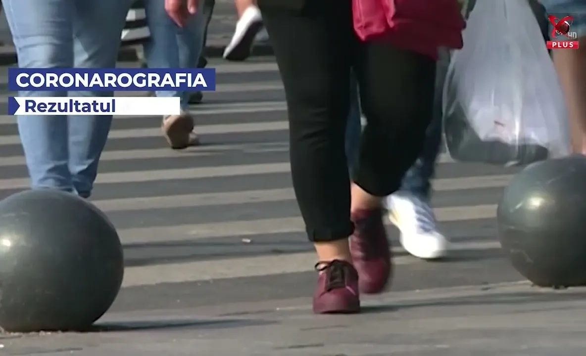 Investigația care verifică arterele inimii