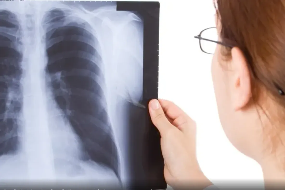 Investigația recomandată persoanelor cu risc pulmonar crescut