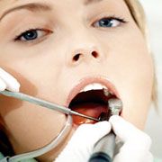 Mii de români stabiliţi în Spania merg la dentiştii români de acolo