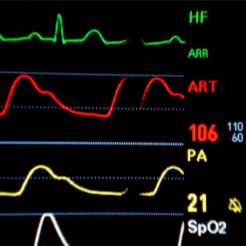 Urgenţa Spitalului din Miercurea Ciuc are un singur medic angajat 
