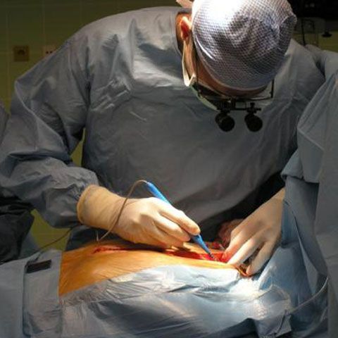 Un chirurg american i-a cerut fostei lui soţii să-i returneze rinichiul pe care i l-a donat în timpul căsniciei