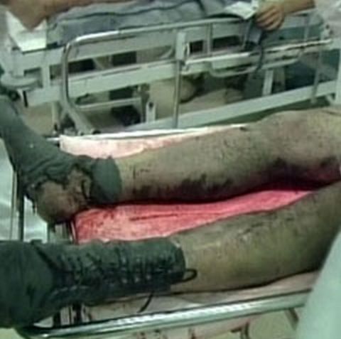 Israelul foloseşte o armă puţin cunoscută şi foarte puternică în Gaza, afirmă doi medici norvegieni 