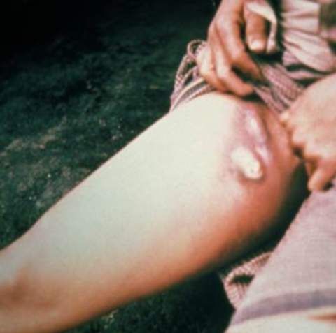 40 de combatanţi Al-Qaida au murit de ciumă în Algeria 