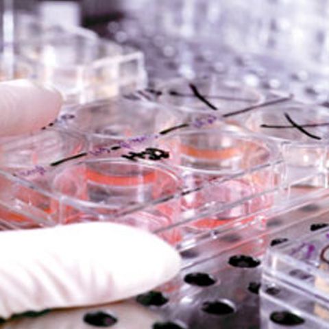 SUA autorizează primul test clinic pe oameni care foloseşte celule suşă embrionare