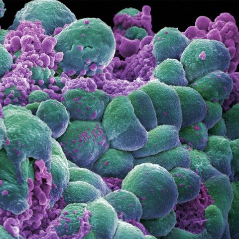 Secretul protecţiei împotriva cancerului a fost descoperit 