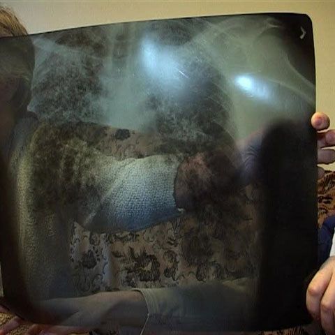 40 de bolnavi au nevoie urgentă de operaţii în străinătate 