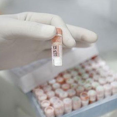 O afecţiune gingivală stimulează proliferarea virusului HIV
