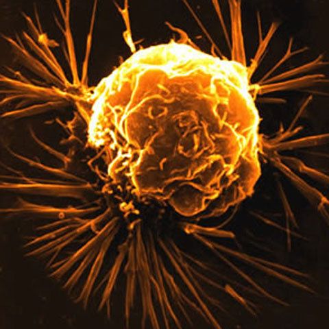 A fost descoperit un nou tip de molecule care pot distruge celulele canceroase