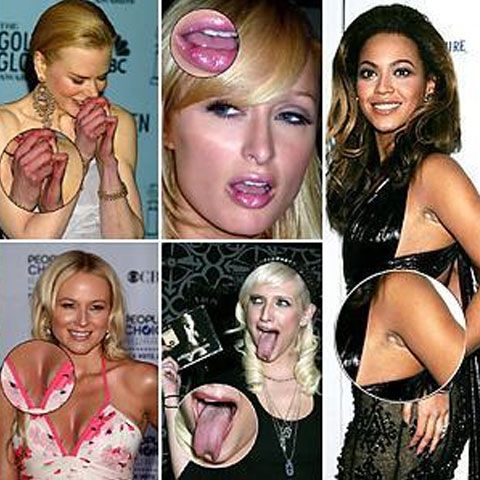 Şi vedetele au defecte