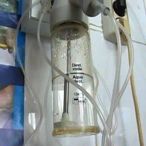 O fetiţă de 13 ani din Prahova a murit după ce a fost operată de apendicită 