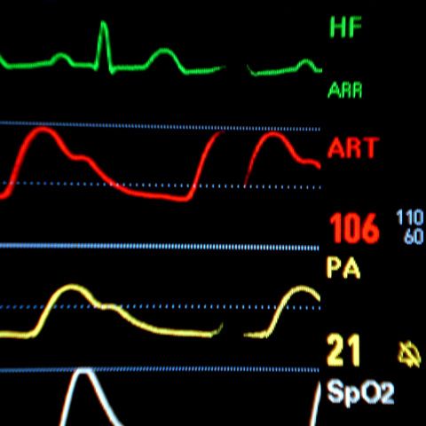 Aparatură de zeci de mii de euro, nefolosită la Spitalul din Bârlad