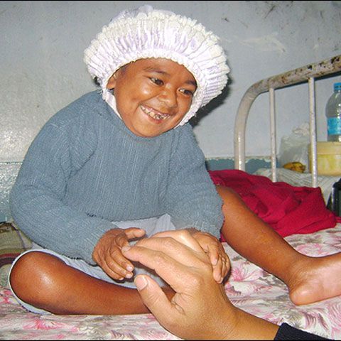 Un indian de 26 de ani trăieşte în corpul unui copil de doi ani