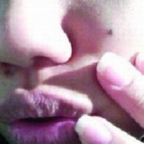 Consultaţii dermatologice gratuite în toată ţara, pe 25 mai