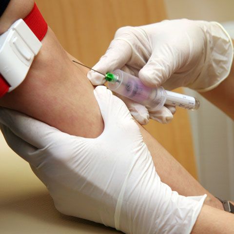 MS şi CNAS nu iau în calcul un plan naţional pentru depistarea bolnavilor de hepatită B şi C