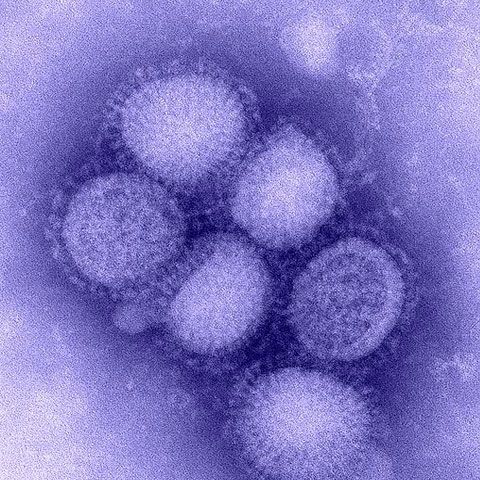 Gripa porcină aproape de România: Rusia confirmă primul caz