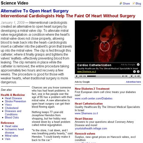 Oamenii de ştiinţă au găsit o alternativă eficientă la operaţia pe cord deschis