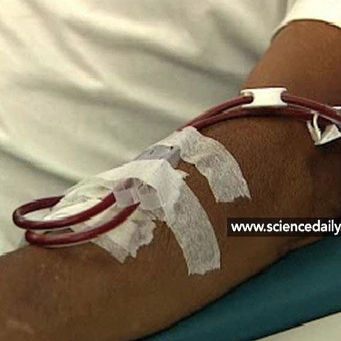 Aparatul care curăţă sângele de viruşi şi toxine a fost proiectat în SUA