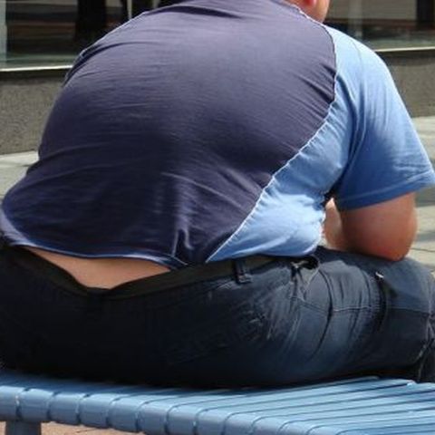 Obezii au creierul mai mic şi sunt predispuşi bolii Alzheimer