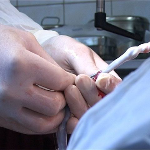 Suferinzii de boli hematologice au mai multe şanse prin inaugurarea Registrul Donatorilor Voluntari de Celule Stem