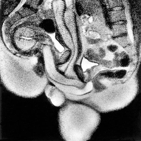 Un cercetător olandez a realizat un film cu imagini RMN din timpul unui act sexual