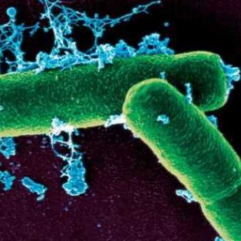 Un caz de antrax la om a fost confirmat în judeţul Botoşani