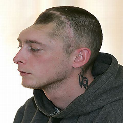 Un tânăr a supravieţuit după ce şi-a pierdut o jumătate de craniu într-o bătaie - ATENŢIE, IMAGINI ŞOCANTE!