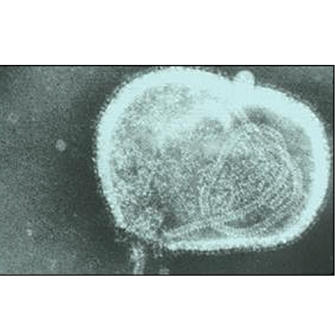 ONU face scenarii apocaliptice: Gripa nouă ar putea face milioane de victime în ţările sărace