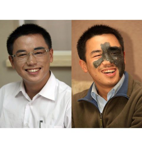 Un student din China are o faţă nouă, după îndepărtarea unui semn din naştere