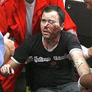 A murit fanul lui Toulouse bătut de suporterii lui Partizan 