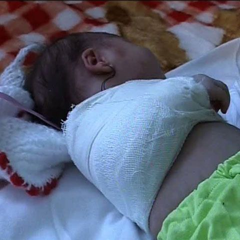 Un nou-născut a fost externat de la maternitatea din Ploieşti, deşi avea o mână ruptă