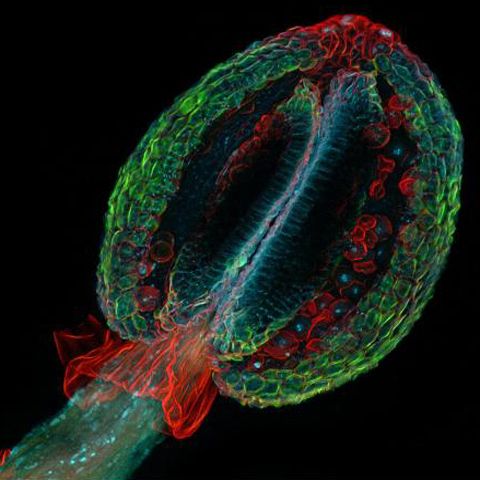 Cele mai artistice imagini microscopice - GALERIE FOTO