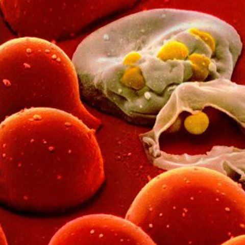 Aproape o treime dintre seropozitivii din Uniunea Europeană ignoră infectarea cu HIV
