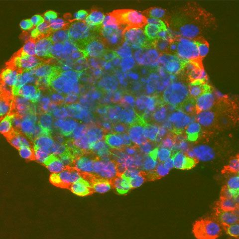 Piaţa celulelor stem din România se află la primul caz de compatibilitate