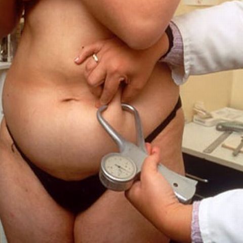 Pacienţii graşi sunt mai puţin respectaţi de medici