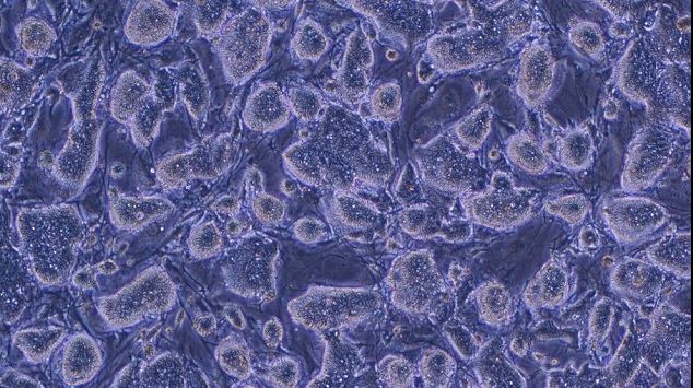 Primul tratament cu celule stem pentru vindecarea orbirii va fi testat pe oameni anul viitor