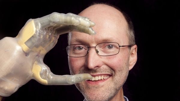 O fostă pianistă a primit primele degete bionice din lume