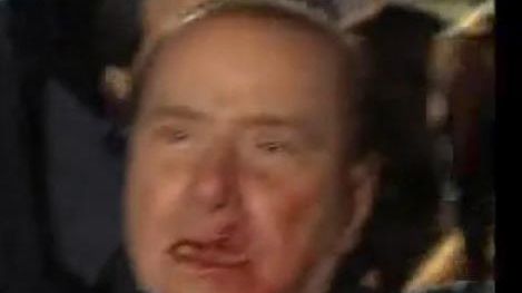 Berlusconi s-a ales cu nasul spart şi doi dinţi rupţi. VEZI VIDEO