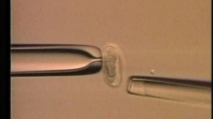 Singurătatea creşte riscul îmbolnăvirii de cancer