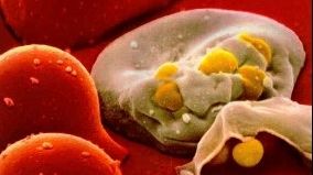 Numărul cazurilor de infectare cu HIV a scăzut în România cu 20%, în acest an