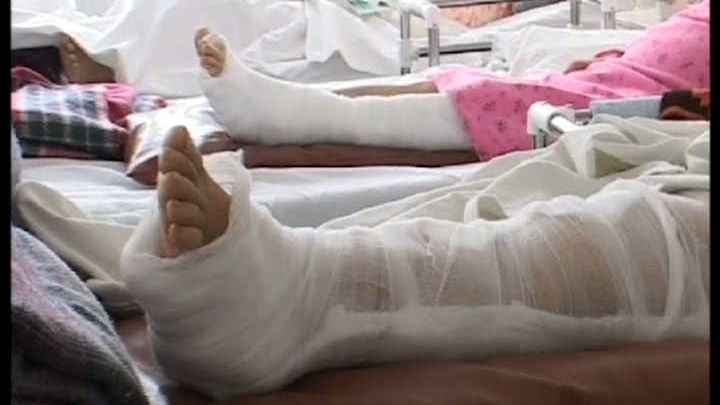 Peste 50 de ploieşteni se internează în fiecare zi la Ortopedie, cu fracturi sau luxaţii