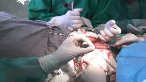 SUPER BACTERIA de spital care îi sperie pe specialiști. Se hrănește cu plasticul din bandaje și implanturi